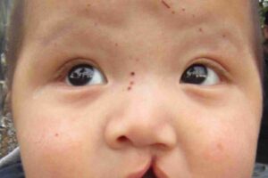 American Legion Post TH01 & the Tawanchai Foundation (TFC) – Part III